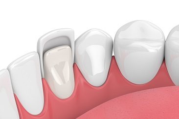 estetica dentara